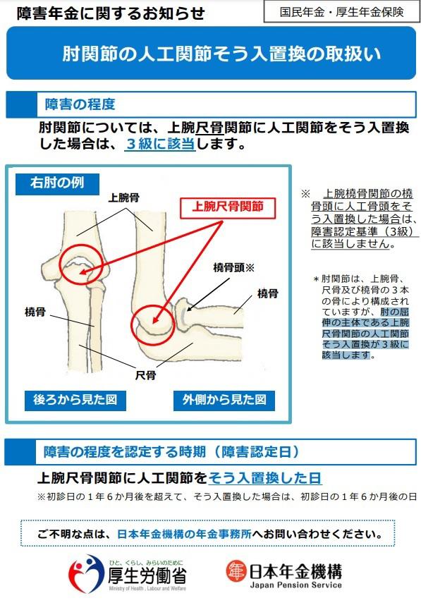 https://www.shougai-navi.com/intro/entry_img/hijikansetsu.jpg